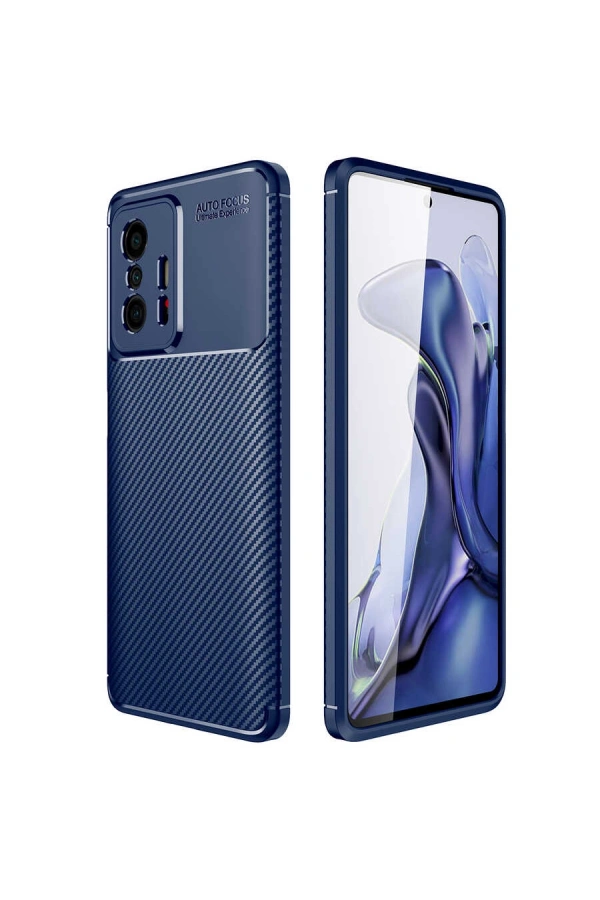 Xiaomi Mi 11T 5G Kılıf Zore Negro Silikon Kapak