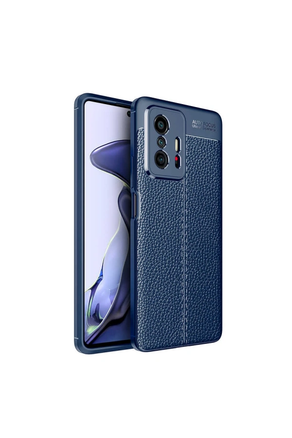 Xiaomi Mi 11T 5G Kılıf Zore Niss Silikon Kapak