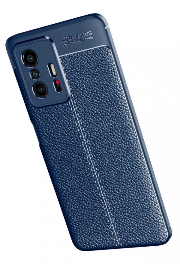 Xiaomi Mi 11T 5G Kılıf Zore Niss Silikon Kapak