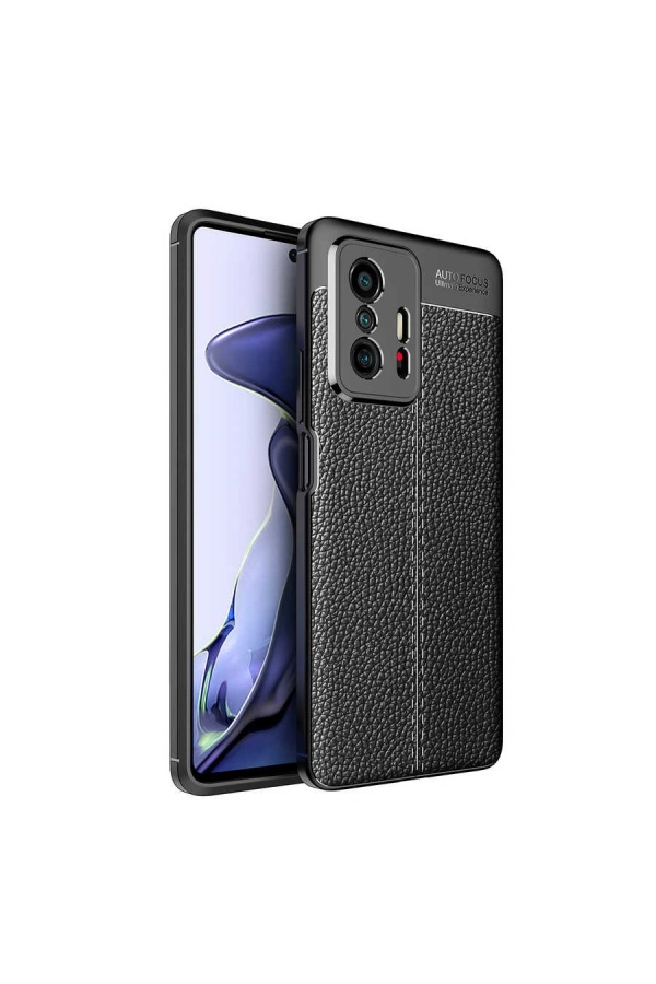 Xiaomi Mi 11T Pro 5G Kılıf Zore Niss Silikon Kapak