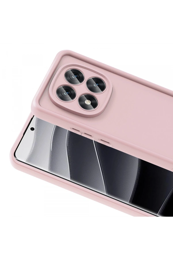 Xiaomi Poco X7 Kılıf Kamera Korumalı Zore Ananas Kapak