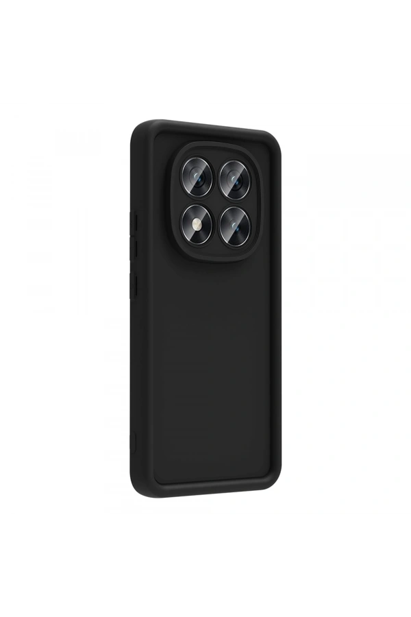 Xiaomi Poco X7 Kılıf Kamera Korumalı Zore Ananas Kapak