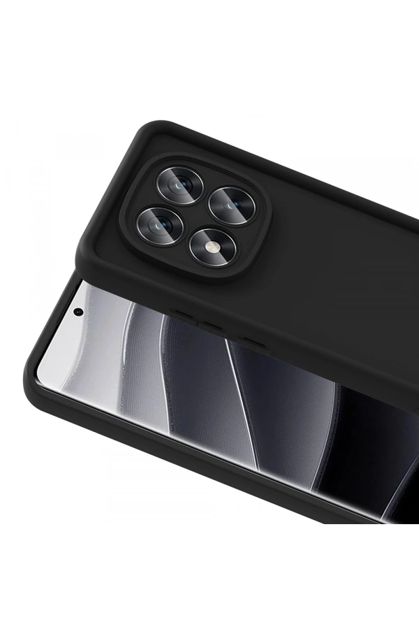 Xiaomi Poco X7 Kılıf Kamera Korumalı Zore Ananas Kapak