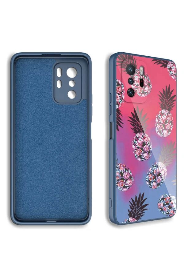 Xiaomi Redmi Note 10 Pro Kılıf Kamera Korumalı Desenli Sert Silikon Zore Epoksi Kapak