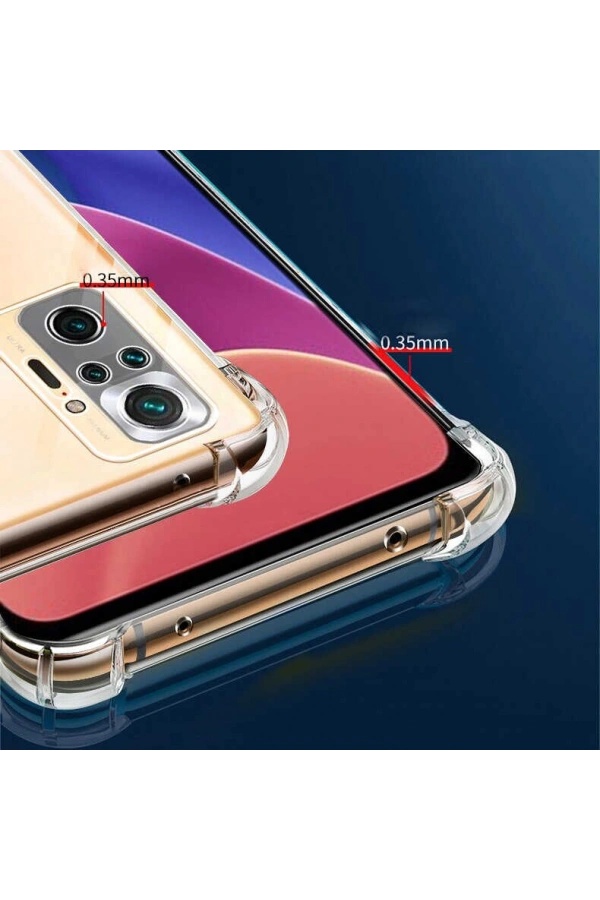 Xiaomi Redmi Note 10 Pro Kılıf Zore Kamera Korumalı Nitro Anti Shock Silikon