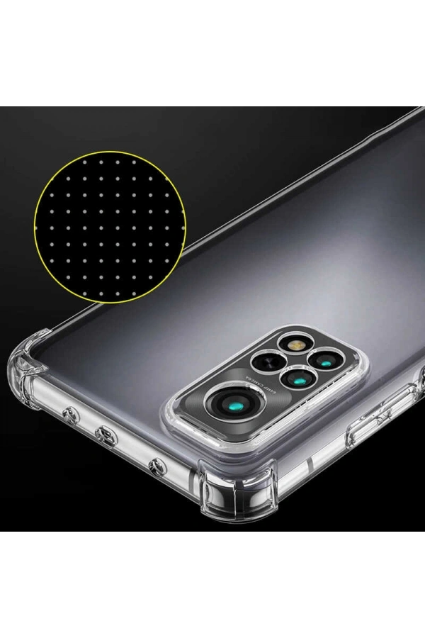 Xiaomi Redmi Note 11 Global Kılıf Zore Kamera Korumalı Nitro Anti Shock Silikon