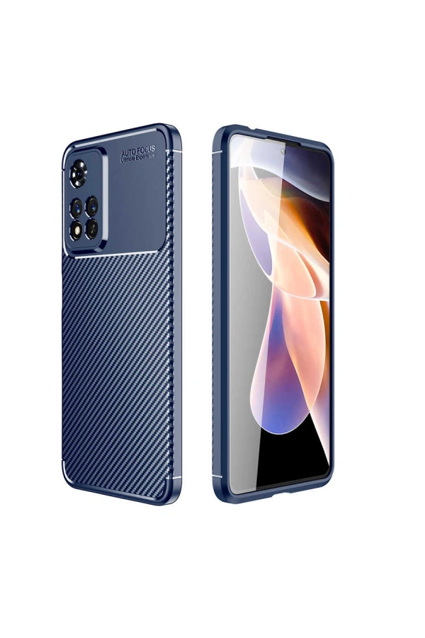 Xiaomi Redmi Note 11 Pro Plus 5G Kılıf Zore Negro Silikon Kapak