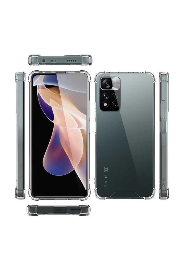 Xiaomi Redmi Note 11 Pro Plus 5G Kılıf Zore Nitro Anti Shock Silikon