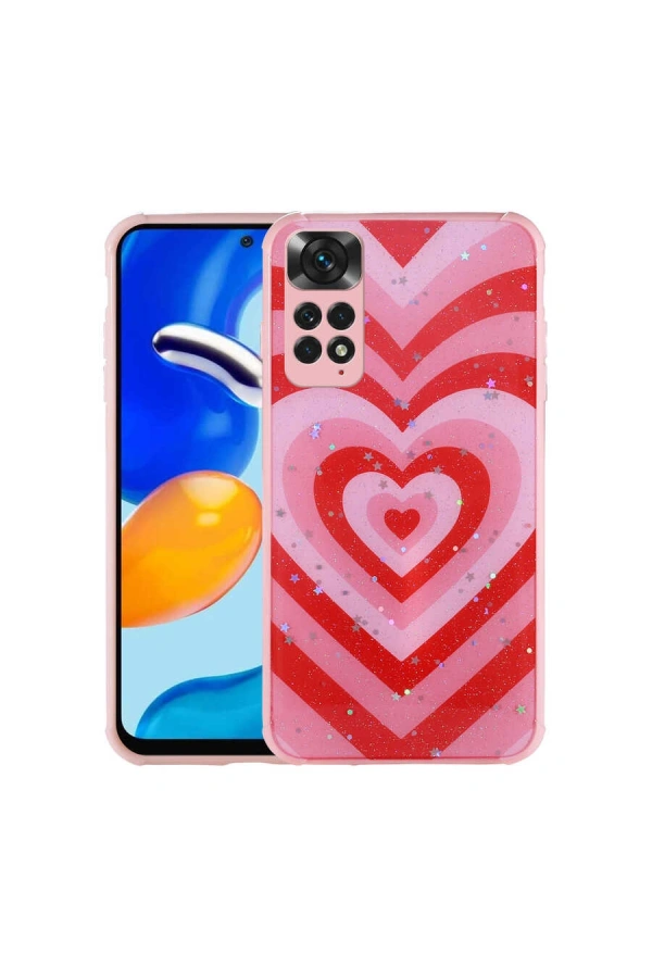 Xiaomi Redmi Note 11S Global Kılıf Simli Desenli Kamera Korumalı Parlak Zore Popy Kapak