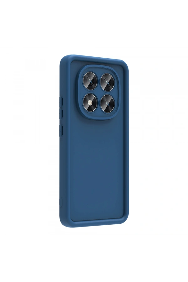 Xiaomi Redmi Note 14 Pro Plus Kılıf Kamera Korumalı Zore Ananas Kapak