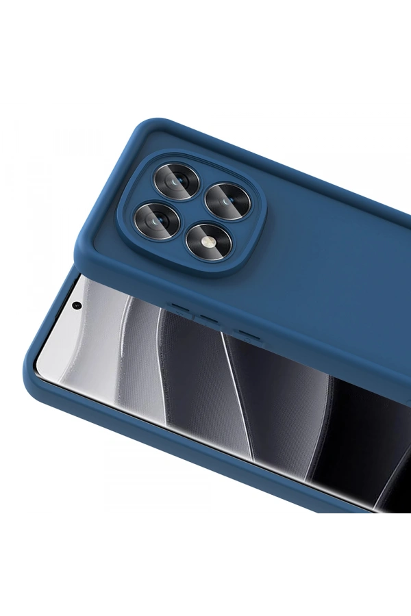 Xiaomi Redmi Note 14 Pro Plus Kılıf Kamera Korumalı Zore Ananas Kapak