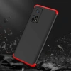 Xiaomi Mi 10T 5G Kılıf Zore Ays Kapak