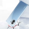 Xiaomi Mi 11 Lite Kılıf Zore Süper Silikon Kapak