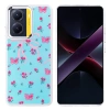 Xiaomi Poco X7 Pro Kılıf Airbag Tasarımlı Zore Hadra Kapak