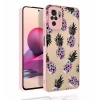 Xiaomi Redmi Note 10 Kılıf Desenli Kamera Korumalı Parlak Zore Nora Kapak