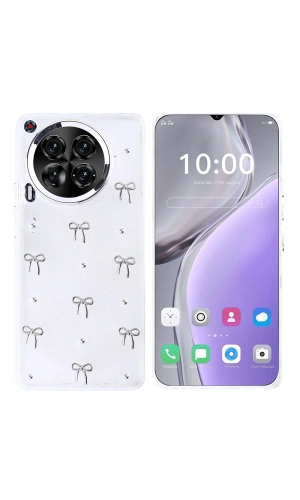 Tecno Camon 30 Kılıf Airbag Tasarımlı Simli Şeffaf Zore Kutup Kapak