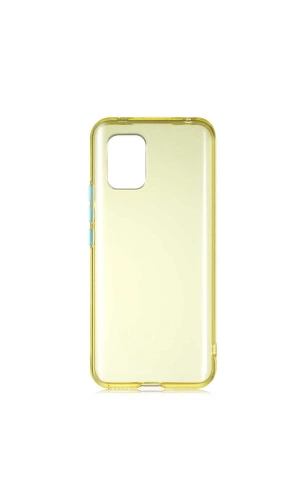 Xiaomi Mi 10 Lite Kılıf Zore Bistro Kapak
