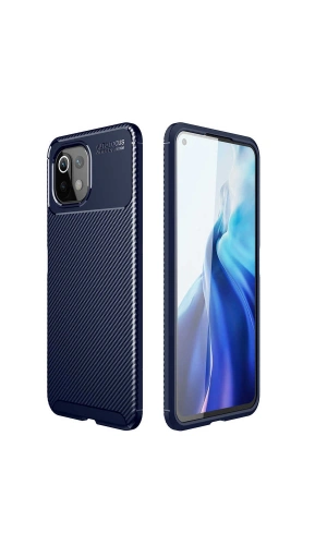 Xiaomi Mi 11 Lite Kılıf Zore Negro Silikon Kapak
