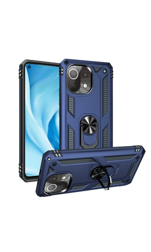 Xiaomi Mi 11 Lite Kılıf Zore Vega Kapak