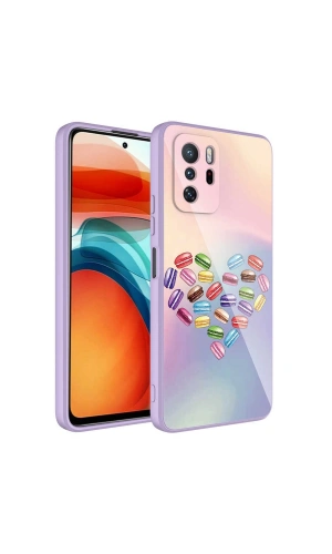 Xiaomi Redmi Note 10 Pro Kılıf Kamera Korumalı Desenli Sert Silikon Zore Epoksi Kapak