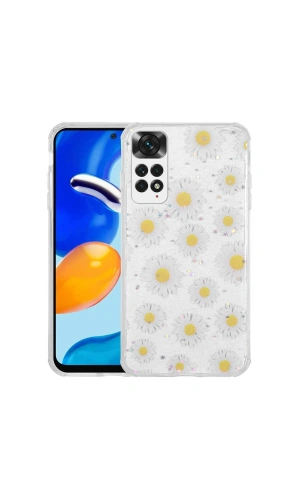 Xiaomi Redmi Note 11 Global Kılıf Simli Desenli Kamera Korumalı Parlak Zore Popy Kapak