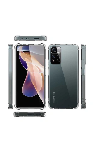 Xiaomi Redmi Note 11 Pro Plus 5G Kılıf Zore Nitro Anti Shock Silikon