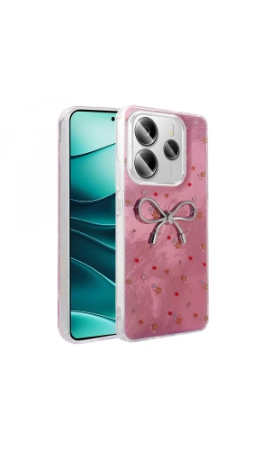 Xiaomi Redmi Note 14 5G Kılıf Kamera Korumalı Figürlü Zore Ponti Silikon Kapak