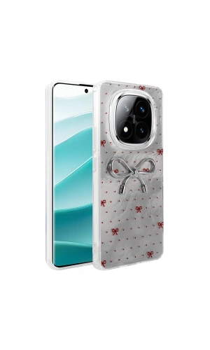 Xiaomi Redmi Note 14 Pro 5G Kılıf Kamera Korumalı Figürlü Zore Ponti Silikon Kapak