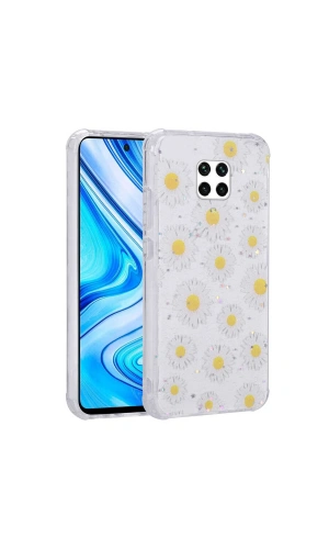Xiaomi Redmi Note 9S Kılıf Simli Desenli Kamera Korumalı Parlak Zore Popy Kapak