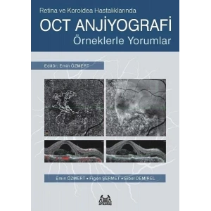 OCT Anjiyografi
