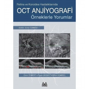 OCT Anjiyografi