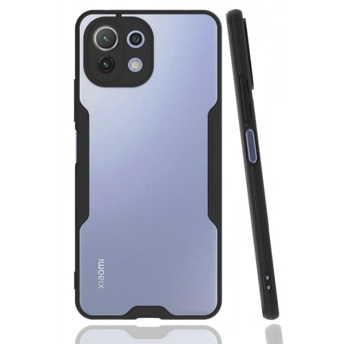 Durukar®   Mİ 11 Lite Kılıf Platin Silikon - Siyah