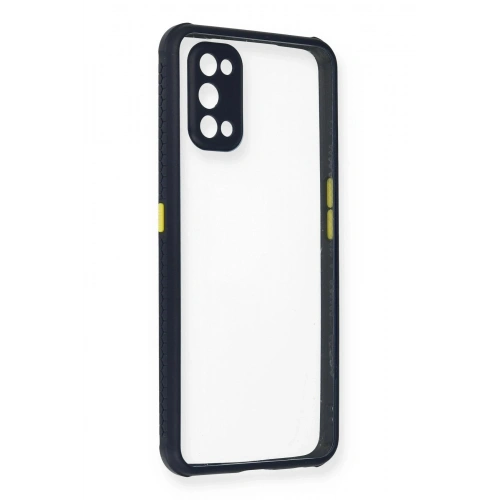 Durukar®  Realme 7 Pro Kılıf Miami Şeffaf Silikon - Lacivert