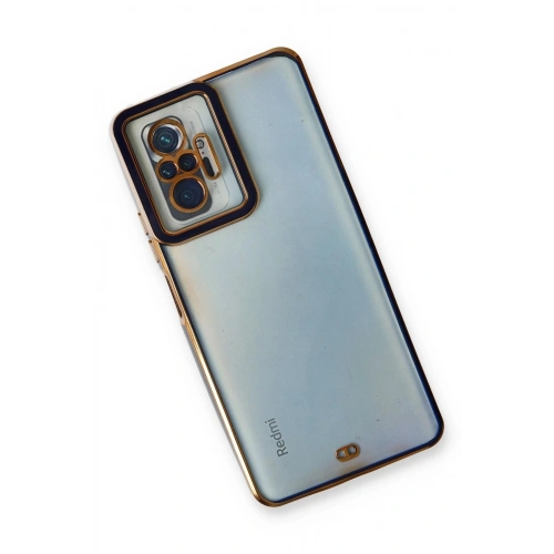 Durukar®   Redmi Note 10 Pro Kılıf Liva Lens Silikon - Mavi