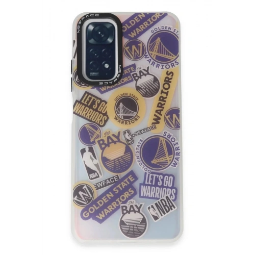 Durukar®   Redmi Note 11 Kılıf Estoril Desenli Kapak - Estoril - 13