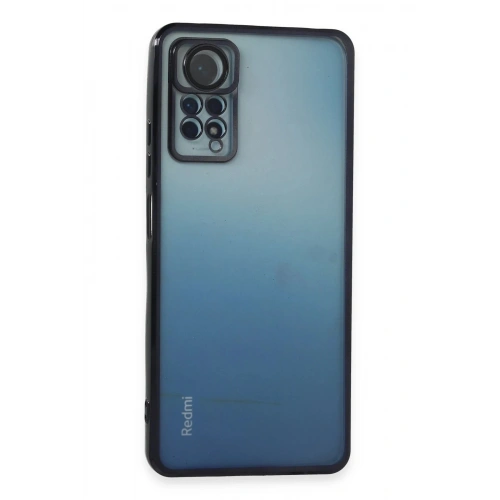Durukar®   Redmi Note 11 Pro Kılıf  Lensli Silikon - Siyah