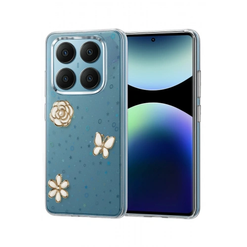 Durukar®   Redmi Note 14 Pro 4G Fiyonk Desenli Kapak - Desen 10