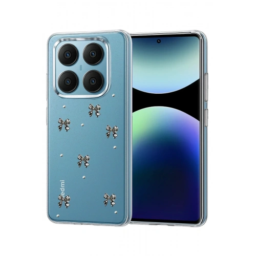 Durukar®   Redmi Note 14 Pro 4G Fiyonk Desenli Kapak - Desen 5
