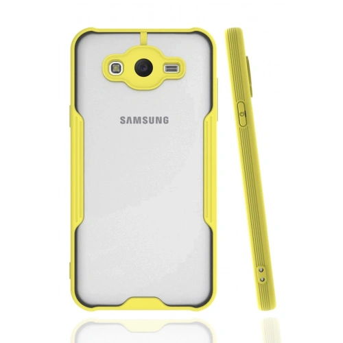 Durukar®  Samsung Galaxy J7 Kılıf Platin Silikon - Sarı
