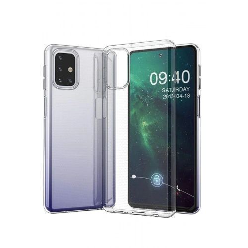 Durukar®  Samsung Galaxy M31S Kılıf Lüx Şeffaf Silikon