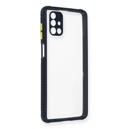 Durukar®  Samsung Galaxy M51 Kılıf Miami Şeffaf Silikon - Lacivert