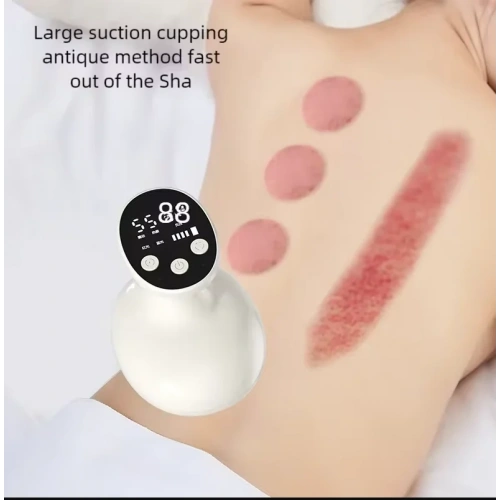 Sıcaklık Emişli Bardak Çekme Terapisi, Vakumlu Masaj Aleti,Terapi Cihazı Masaj Cihazı (5365)