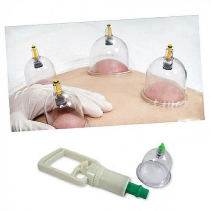12 Piece Vacuum Hijama Cup Suction Set