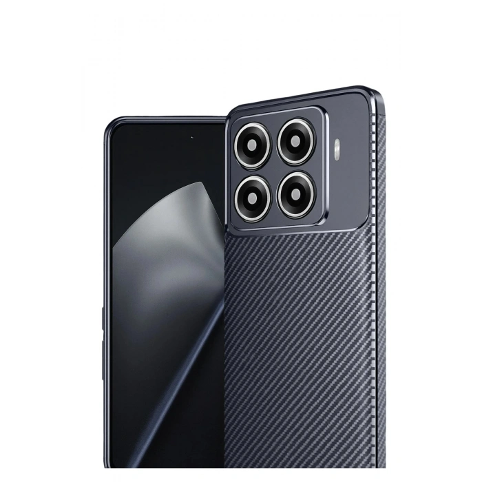 Durukar®   Mi 15T Pro Auto Focus Karbon Kapak - Lacivert
