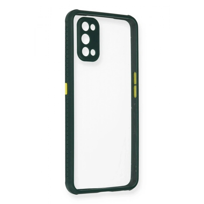 Durukar®  Realme 7 Pro Kılıf Miami Şeffaf Silikon - Koyu Yeşil