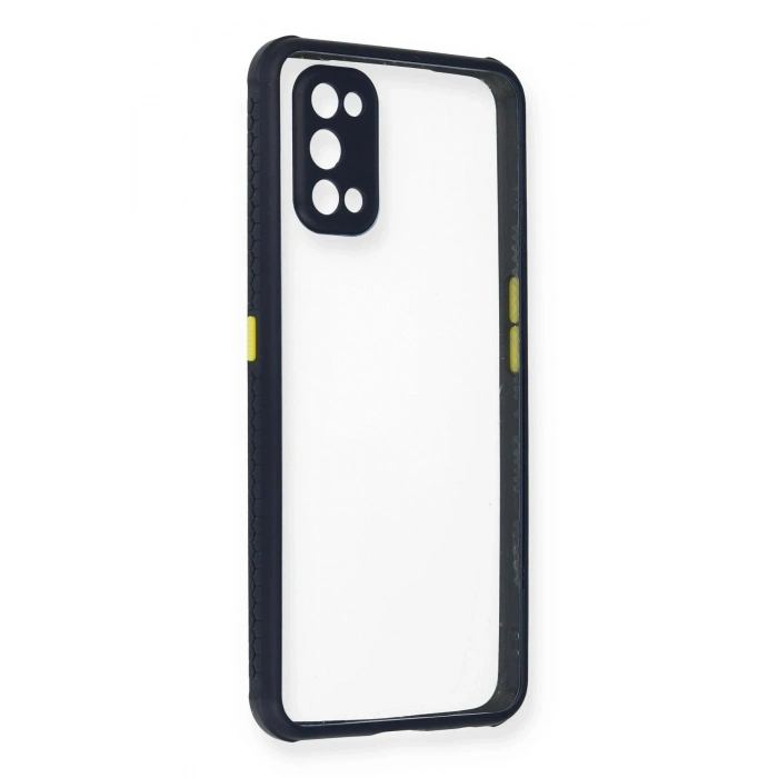 Durukar®  Realme 7 Pro Kılıf Miami Şeffaf Silikon - Lacivert