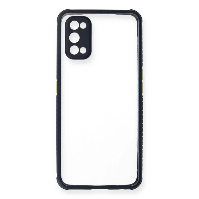 Durukar®  Realme 7 Pro Kılıf Miami Şeffaf Silikon - Lacivert