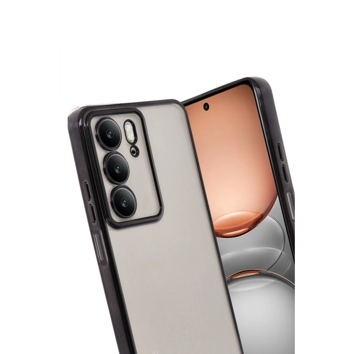 Durukar®  Realme C75 4G Kılıf  Lensli Silikon - Siyah