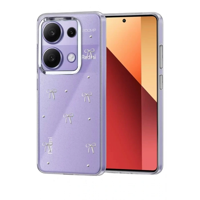 Durukar®   Redmi Note 13 Pro 4G Fiyonk Desenli Kapak - Desen 1