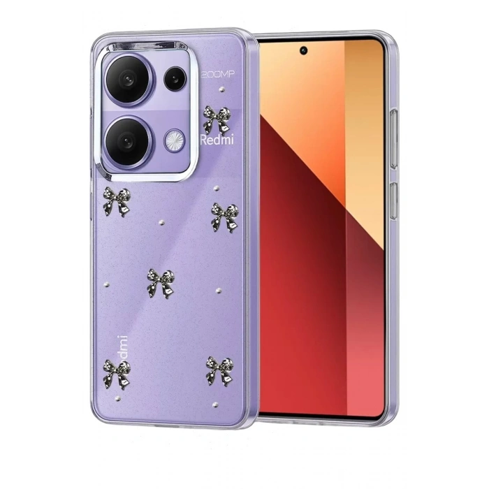 Durukar®   Redmi Note 13 Pro 4G Fiyonk Desenli Kapak - Desen 5